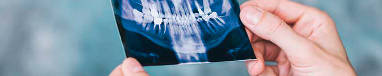 Рентген зубов в Балашихе